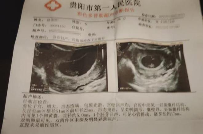 过期孕妇担忧:害怕美味成“隐患”PG电子麻将胡了模拟器火锅底料(图7) 过期孕妇担忧:害怕美味成“隐患”PG电子麻将胡了模拟器火锅底料(图7)